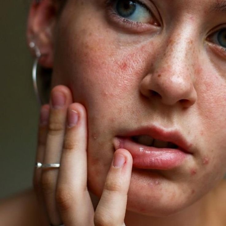 Seasonal Skincare Tips