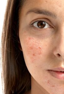 Best Sensitive skincare