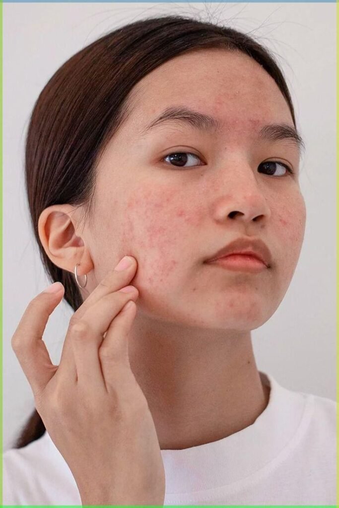 Top Sunscreens for Face