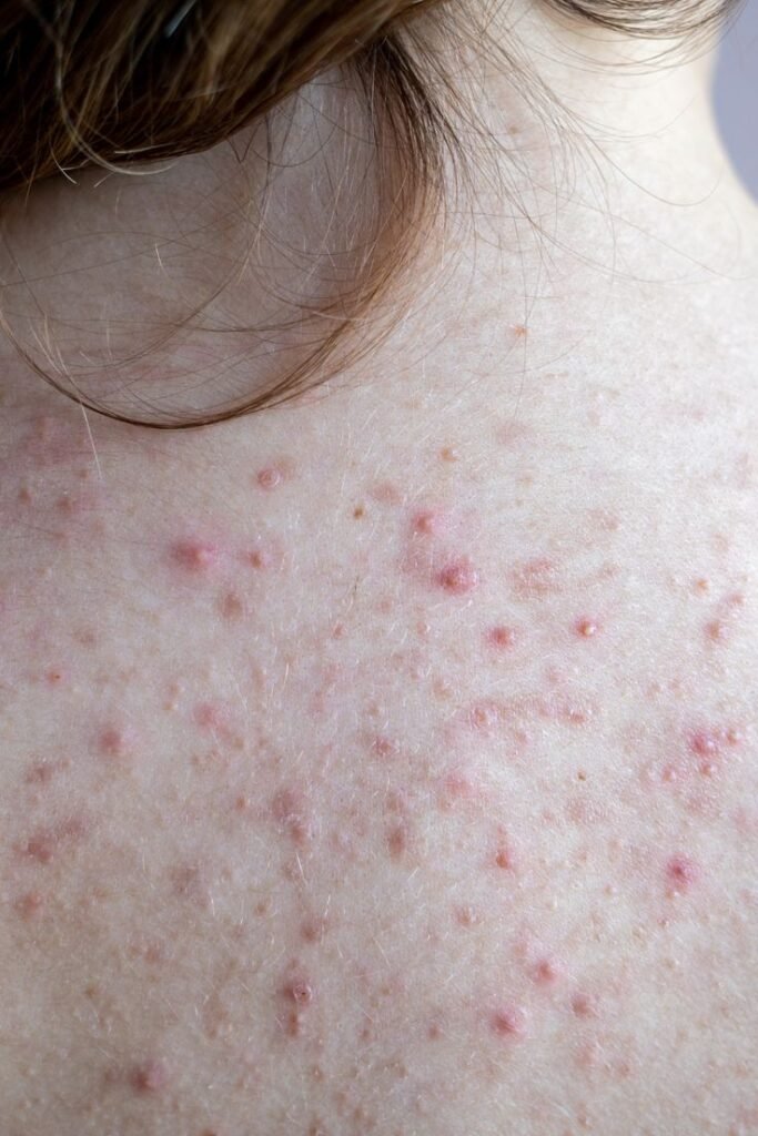 Niacinamide Benefits 08