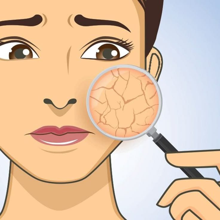 Niacinamide vs Vitamin C