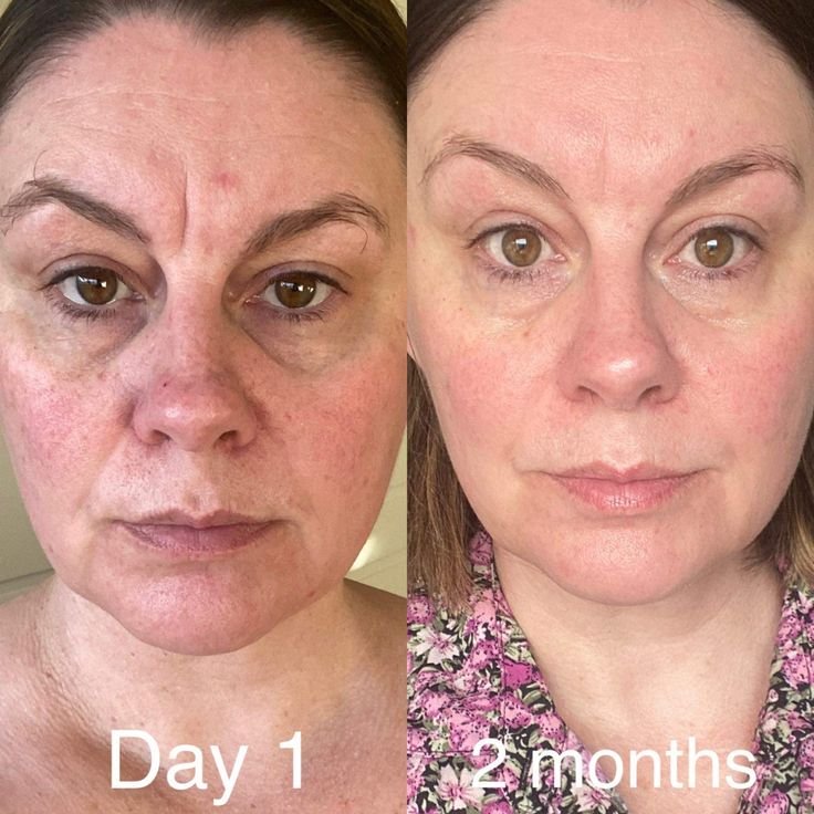 Best Liquid Collagen 2026 05