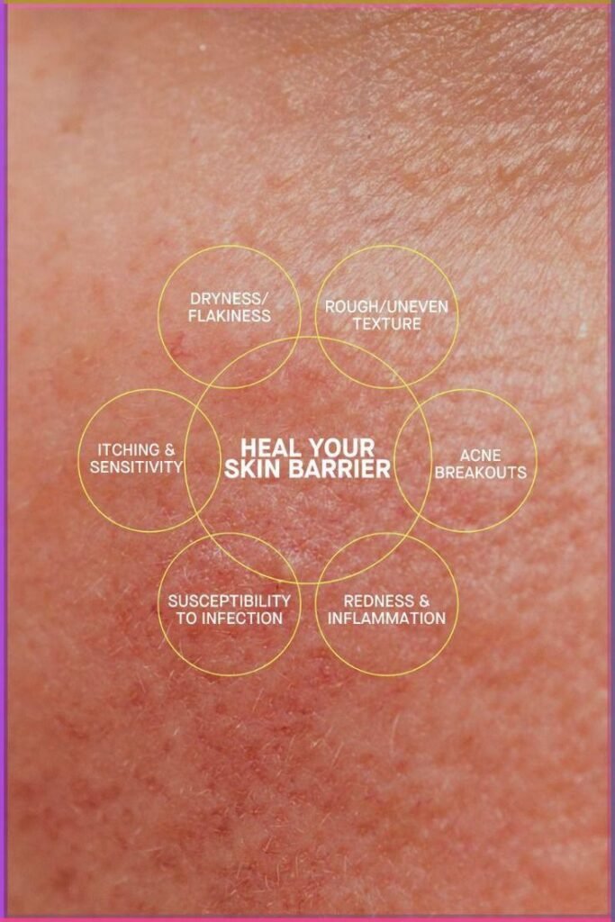 How to Repair Damaged Skin Barrier 02