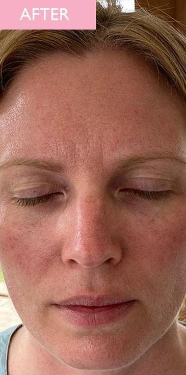 what is Beta-Glucan for skin 02