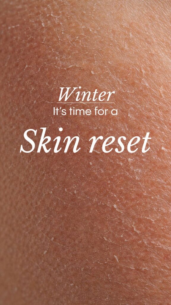 winter skincare tips